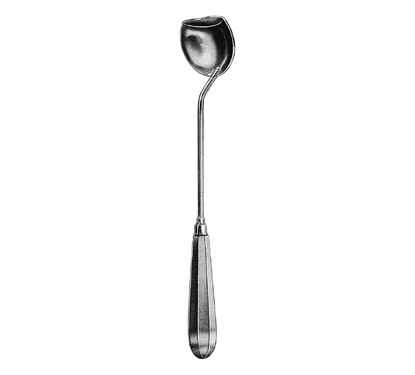 Moore Gall Stone Scoops 28.0 cm